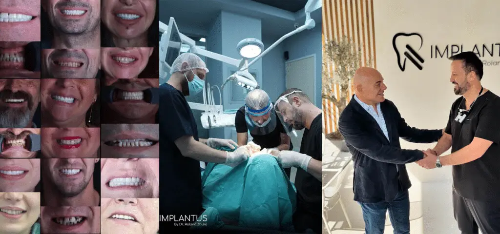 Collage sorrisi e procedure dentistico, logo Implantus